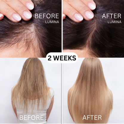 Lumina Hair rejuvenator®